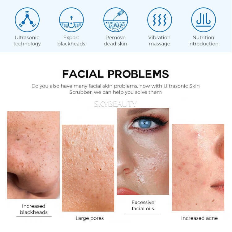 Private Label Facial Ultrasonic Skin Scrubber